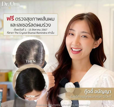 Slider image (7) The Best Medical Hair Center by Dr. Orn 